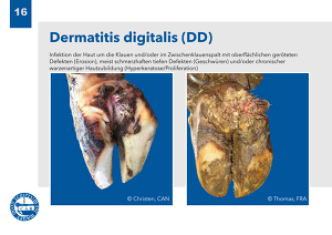 Dermatitis Digitalis (DD) 02