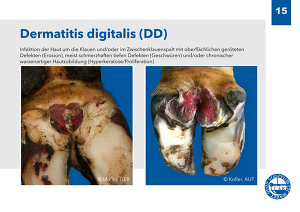 Dermatitis Digitalis (DD)